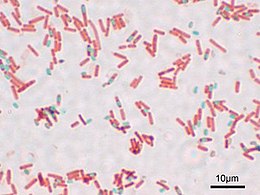 https://upload.wikimedia.org/wikipedia/commons/thumb/7/7a/Bacillus_subtilis_Spore.jpg/260px-Bacillus_subtilis_Spore.jpg